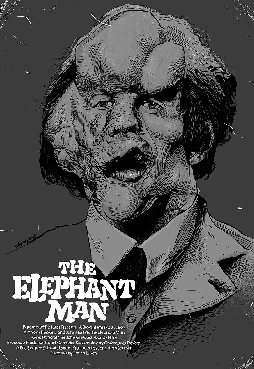 The Elephant Man